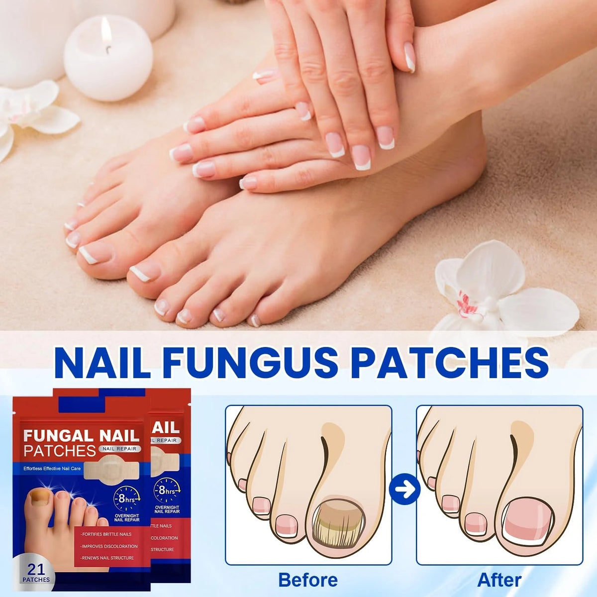 Fungal Nail Repair Patches